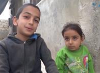  قصة طفلين سوريين يصارعان الوقت قبل تحولهما لمعوقين
